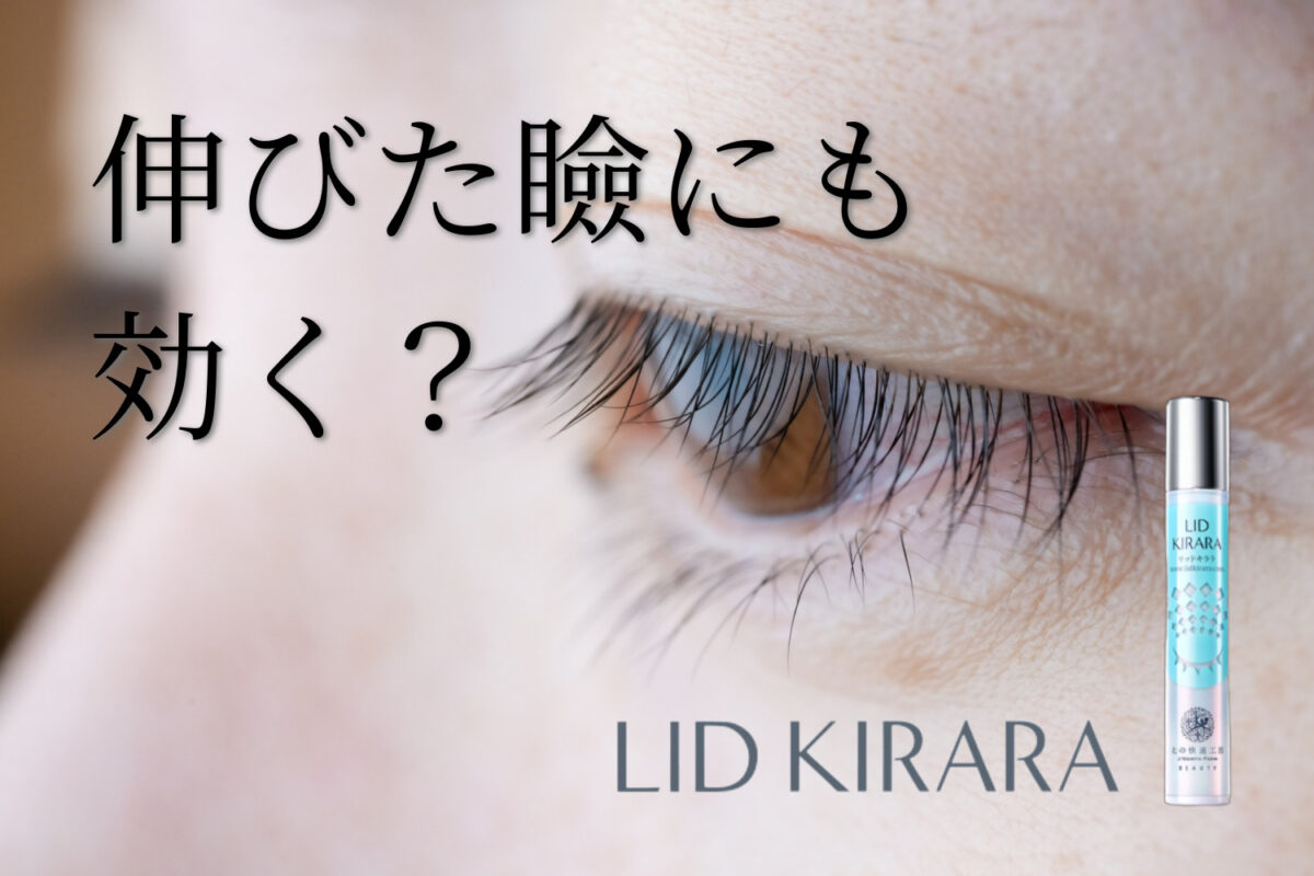 リッドキララは伸びた瞼にも効果ある？速効性と根本ケア力を調査