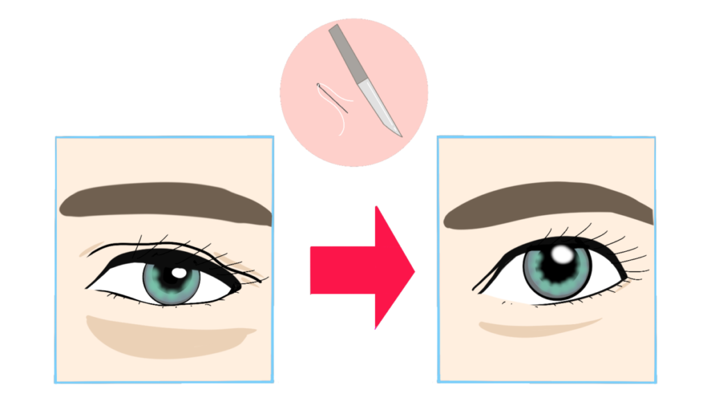リッドキララは伸びた瞼にも使える？速効性と根本ケア力を調査